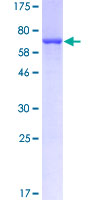 12.5% SDS-PAGE Stained with Coomassie Blue.